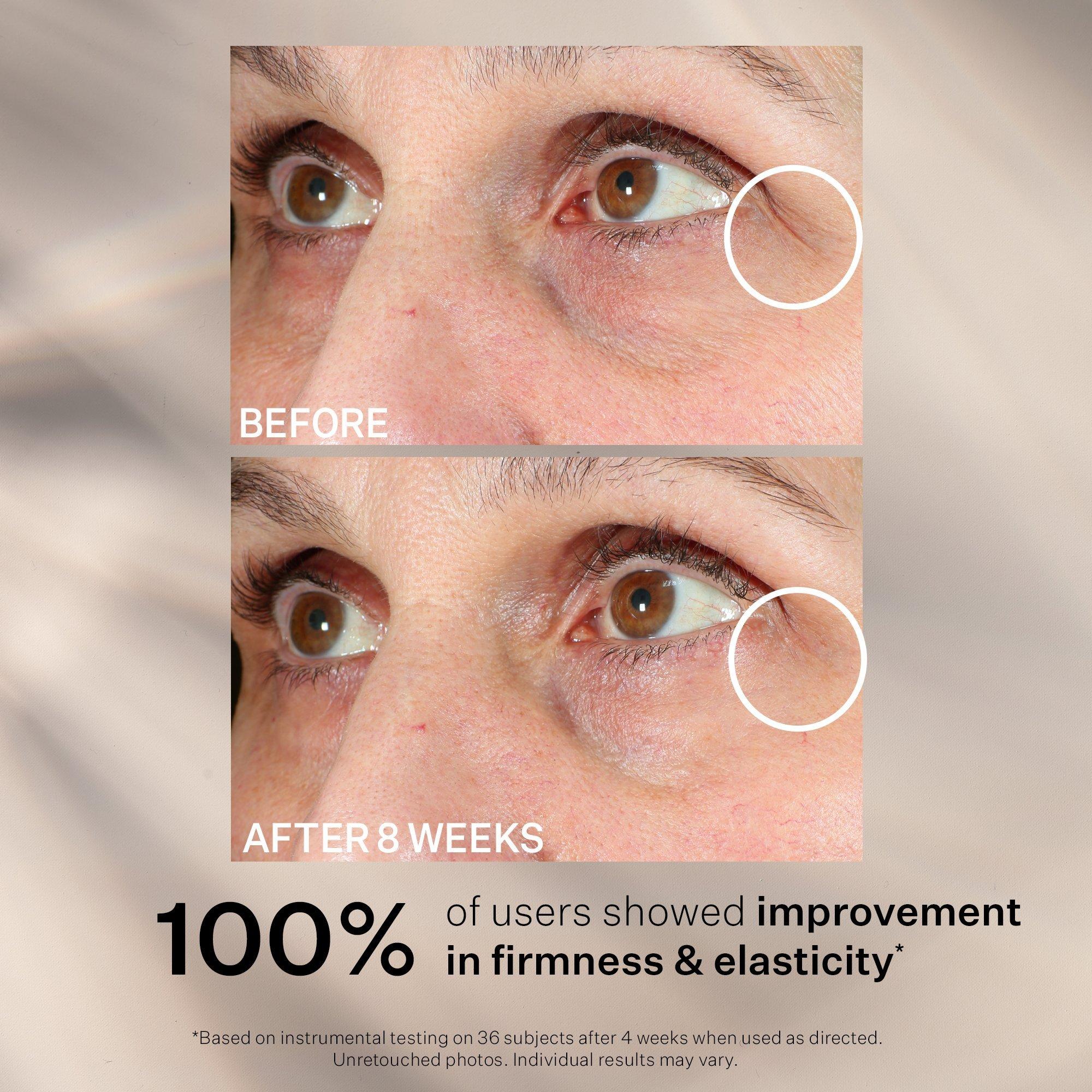 Укрепляющий увлажняющий бальзам для кожи вокруг глаз StriVectin Contour Restore — фото 7