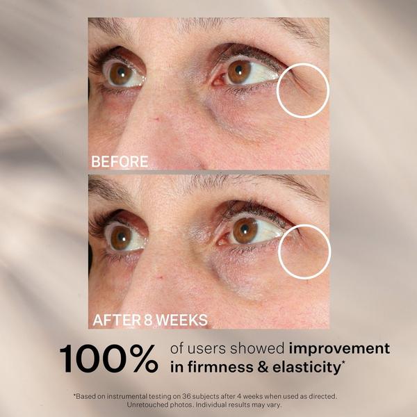 StriVectin Contour Restore Firming Moisture Balm for Eyes #7