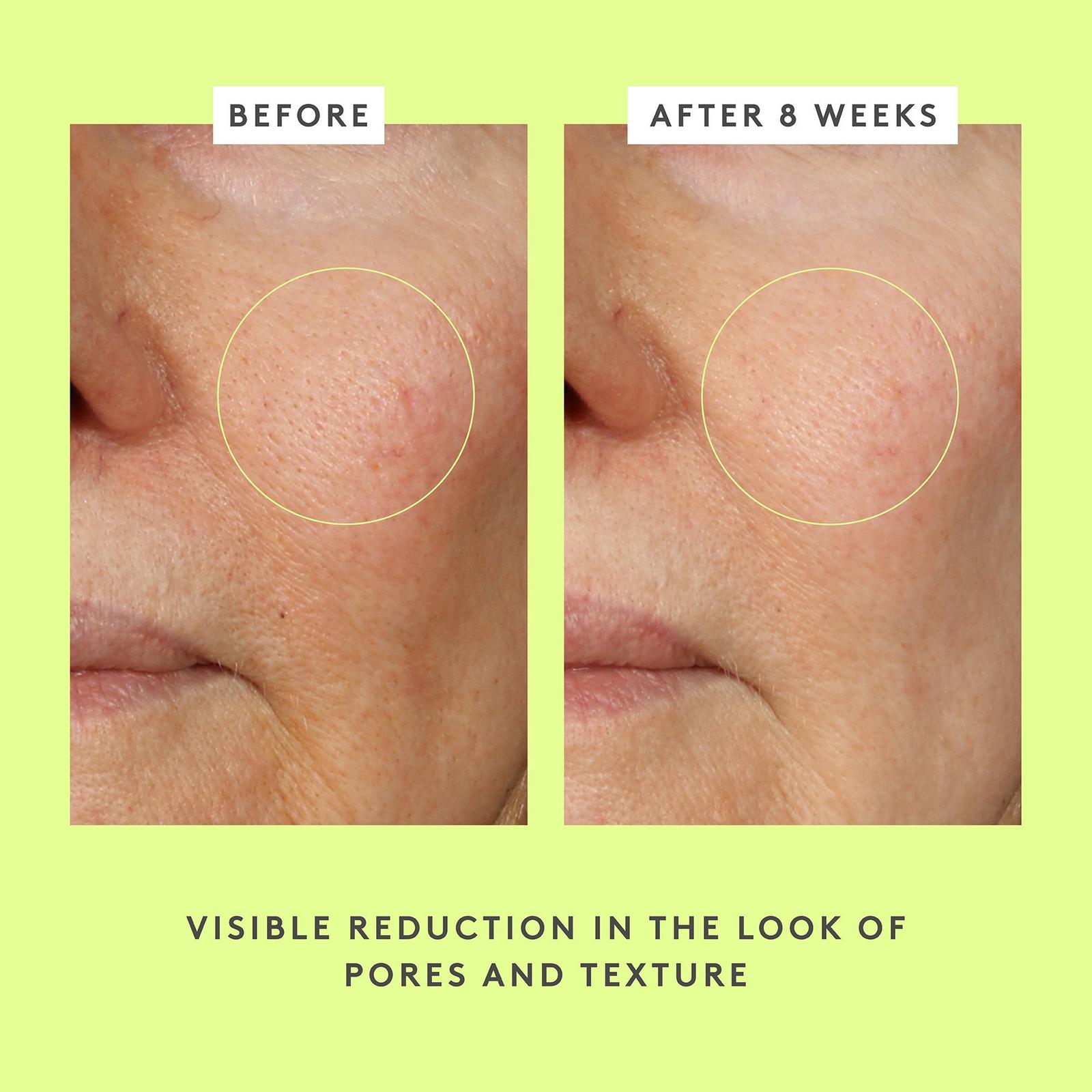 T.L.C Framboos Glycolic Resurfacing Night Serum