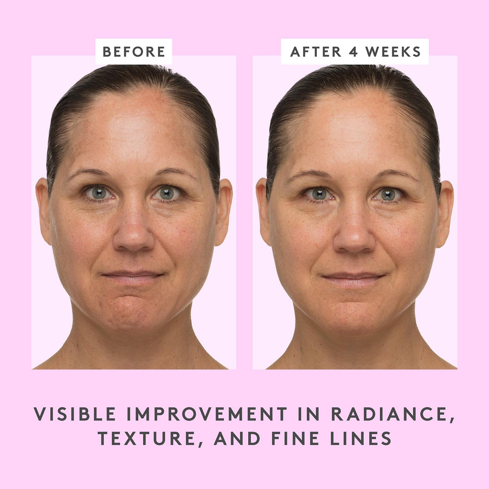 T.L.C. Sukari Babyfacial