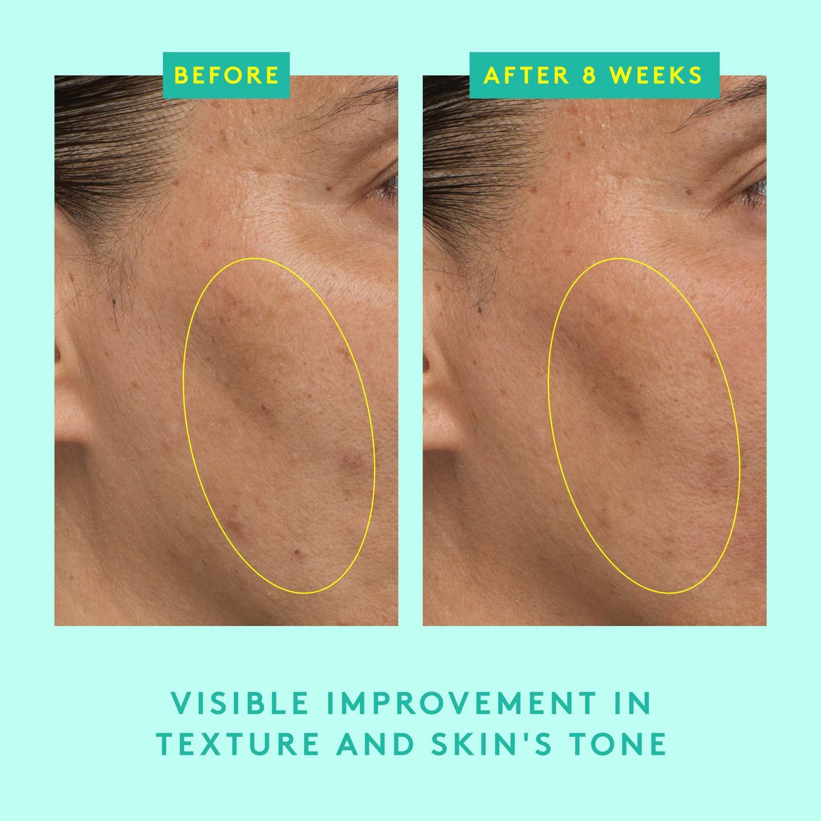Protini Powerpeptide Resurfacing Serum