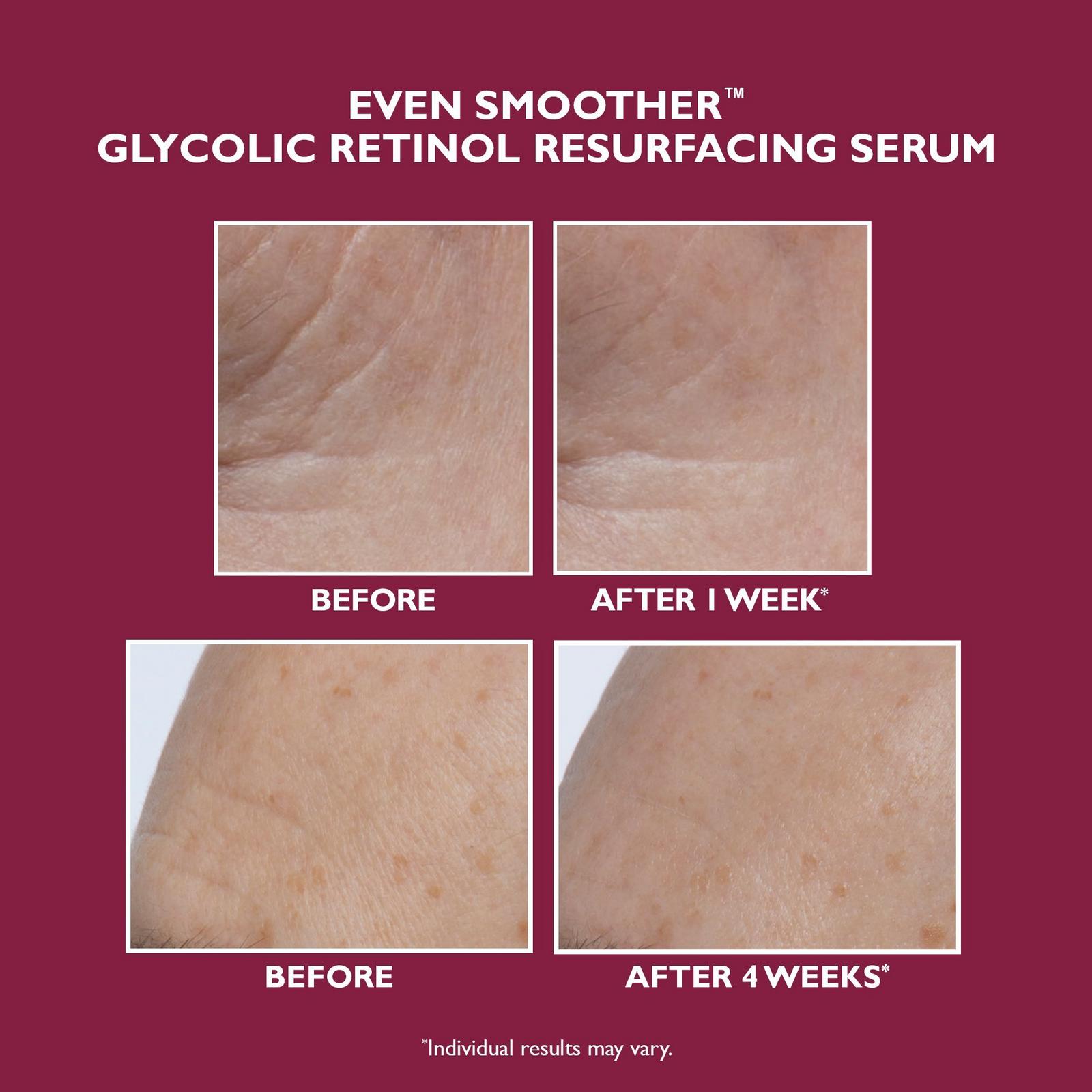 Even Smoother Glycolic Retinol Resurfacing Serum
