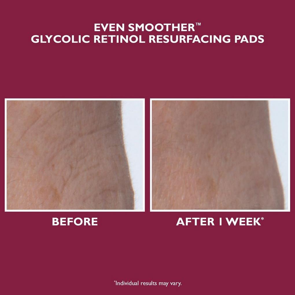 Even Smoother Glycolic Retinol Resurfacing Serum