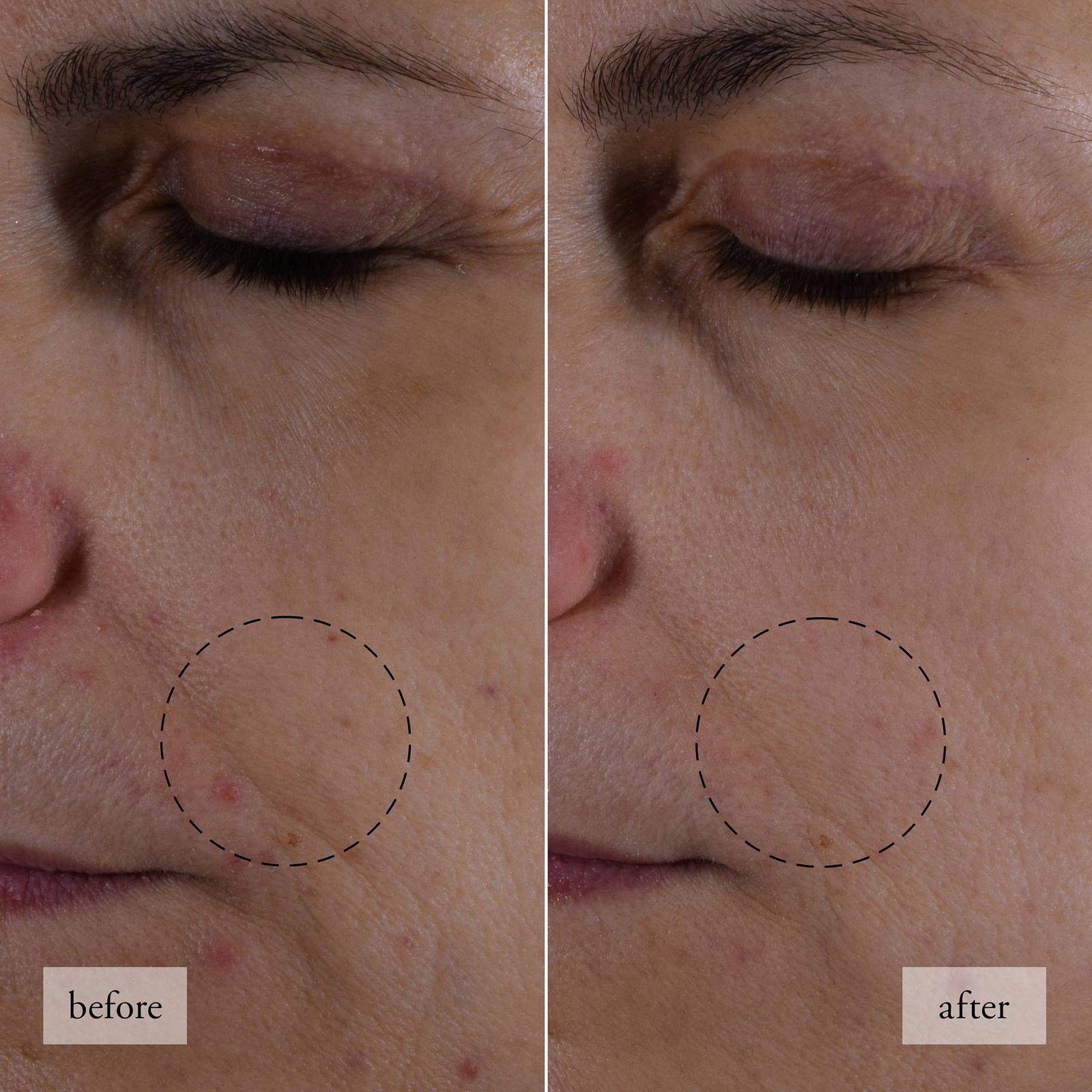 Hope In A Jar Smooth-Glow Multi-Tasking Moisturizer