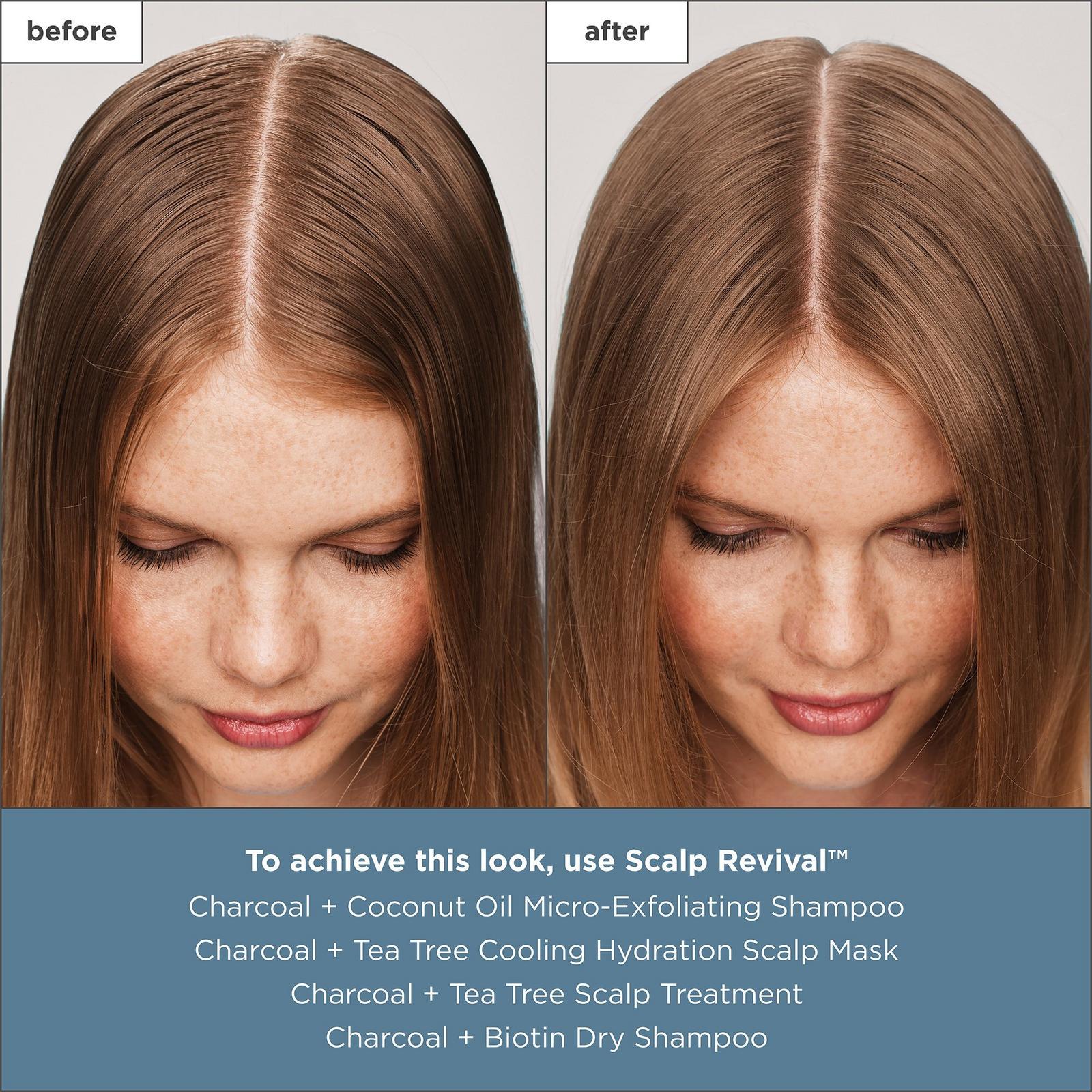 Scalp Revival Charcoal + Tea Tree Scalp Treatment Serum