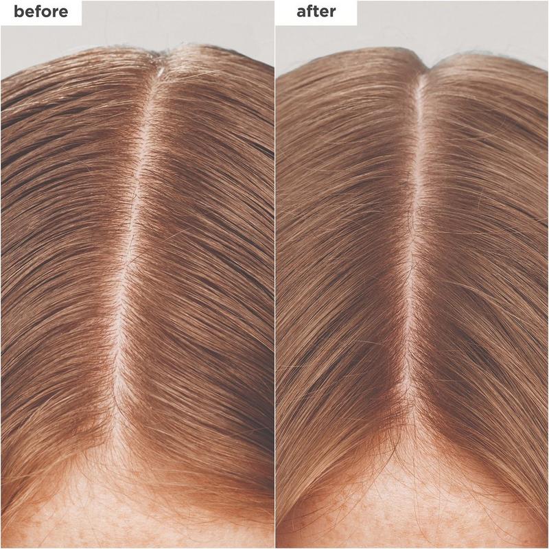Briogeo - Scalp Revival Charcoal + Biotin Dry Shampoo | Ulta Beauty