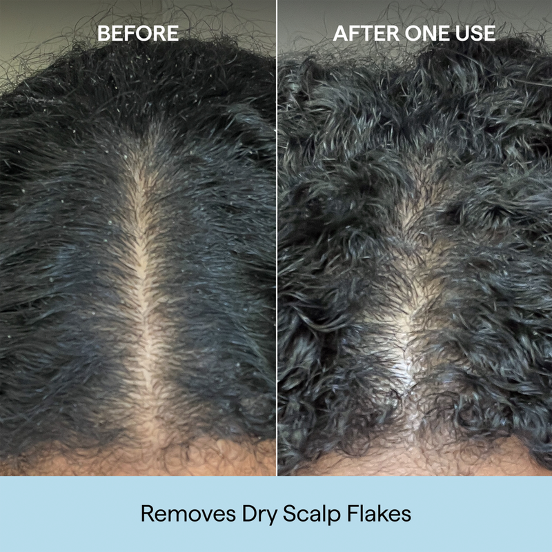 Briogeo - 32.0 oz Scalp Revival Charcoal + Coconut Oil Micro
