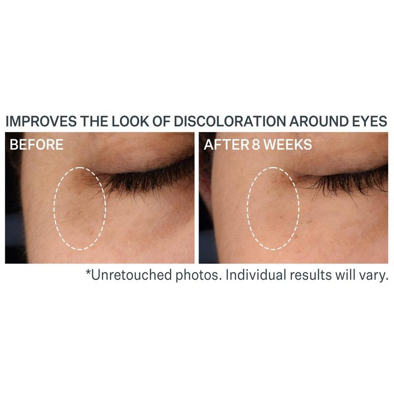 StriVectin - Super-C Dark Circle Brightening Eye Serum
