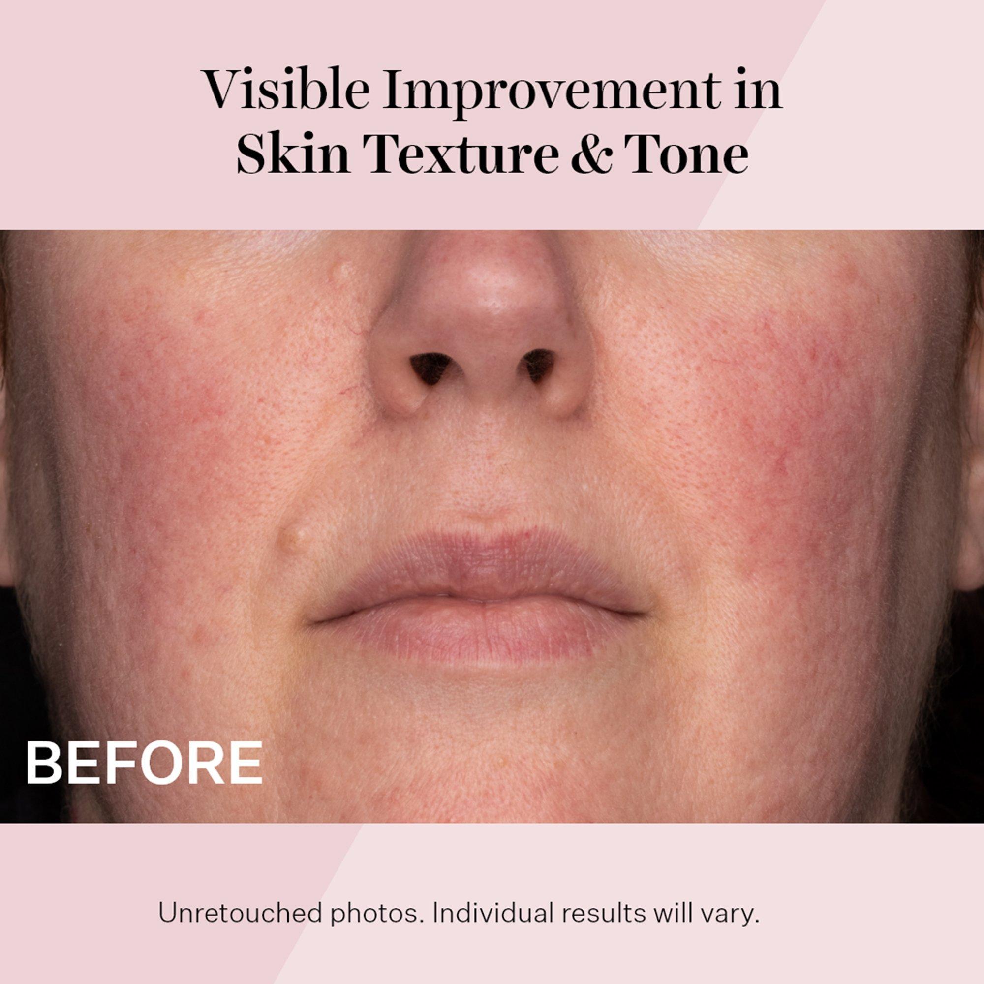 Ежедневный восстанавливающий увлажняющий крем StriVectin Advanced Retinol SPF 30 — фото 6