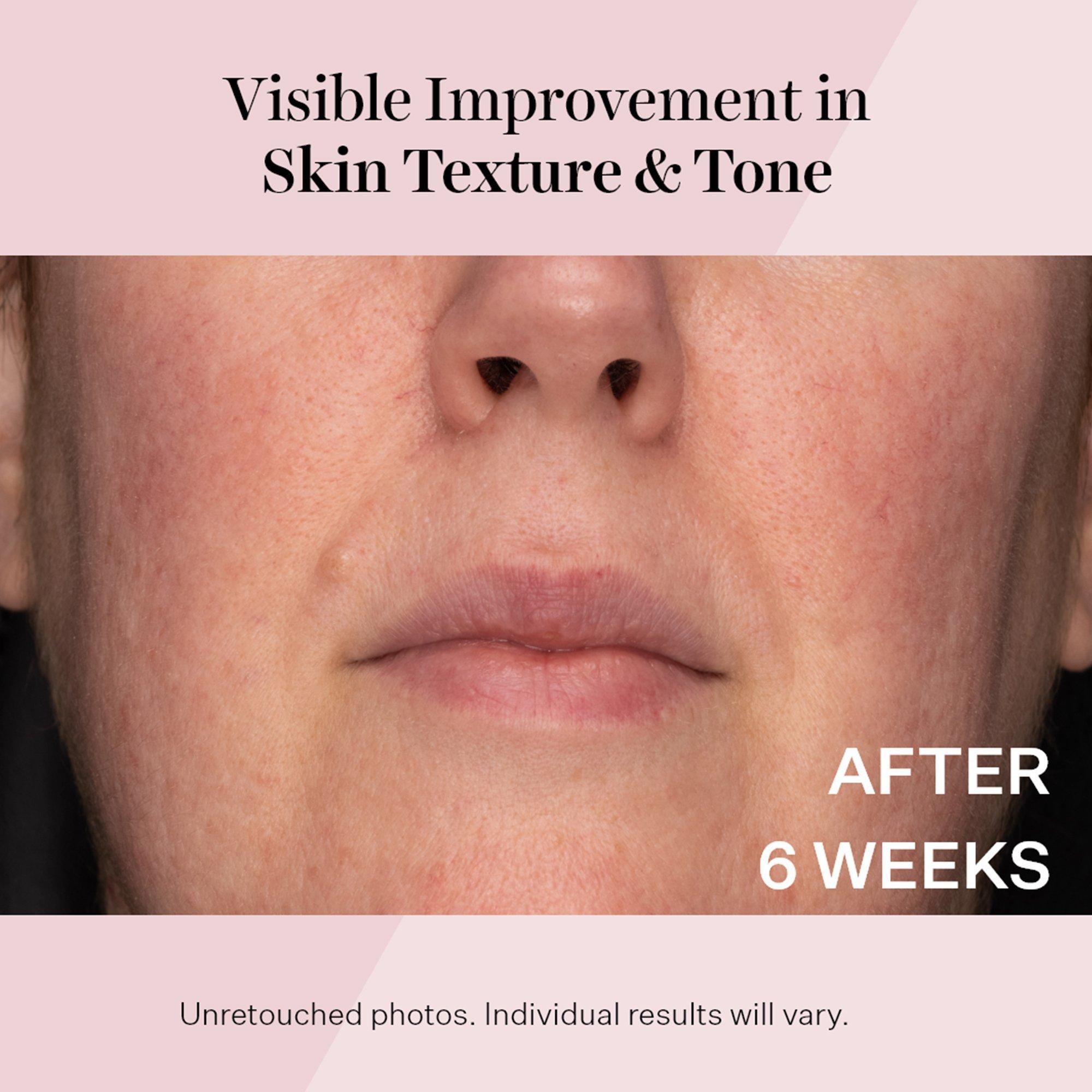 Ежедневный восстанавливающий увлажняющий крем StriVectin Advanced Retinol SPF 30 — фото 7
