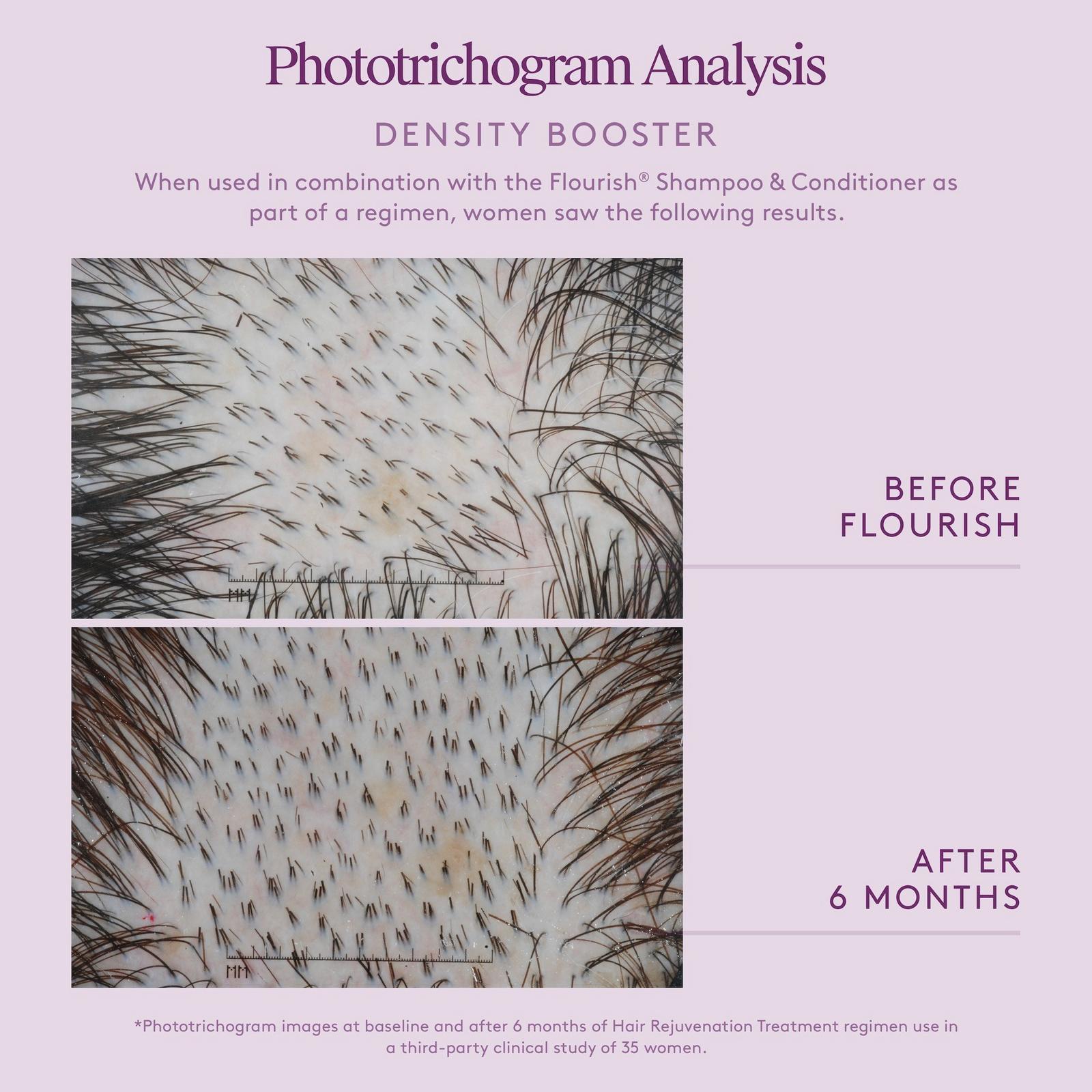 Flourish Healthy Hair Growth Drug-Free Density Booster