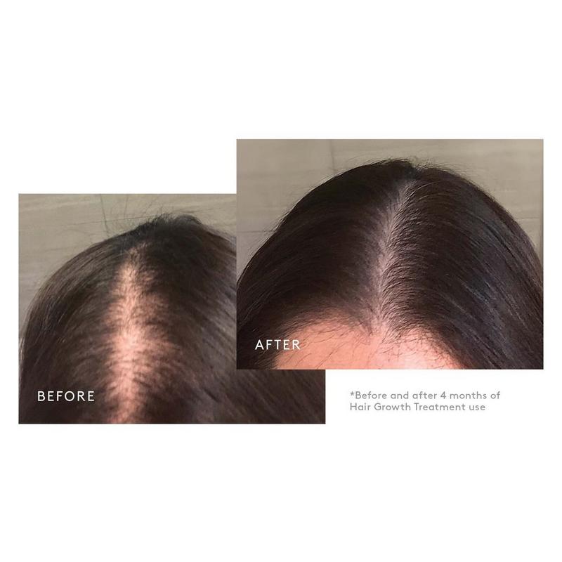 bpc 157 hair growth before and after Peptides for Growth: GHK-Cu, BPC-157, GHK-Biotin Virtue - Flourish Hair Growth