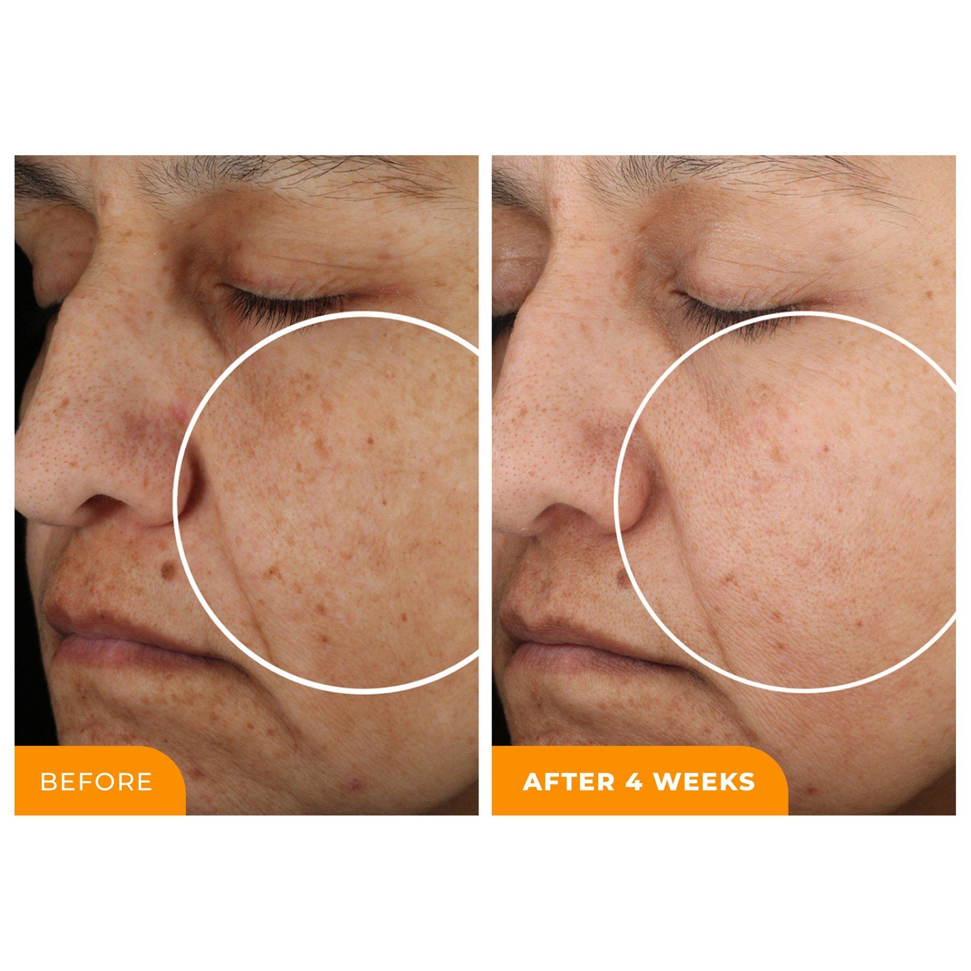 Beautystat Cosmetics Universal C Skin Refiner 20 Vitamin C Brightening