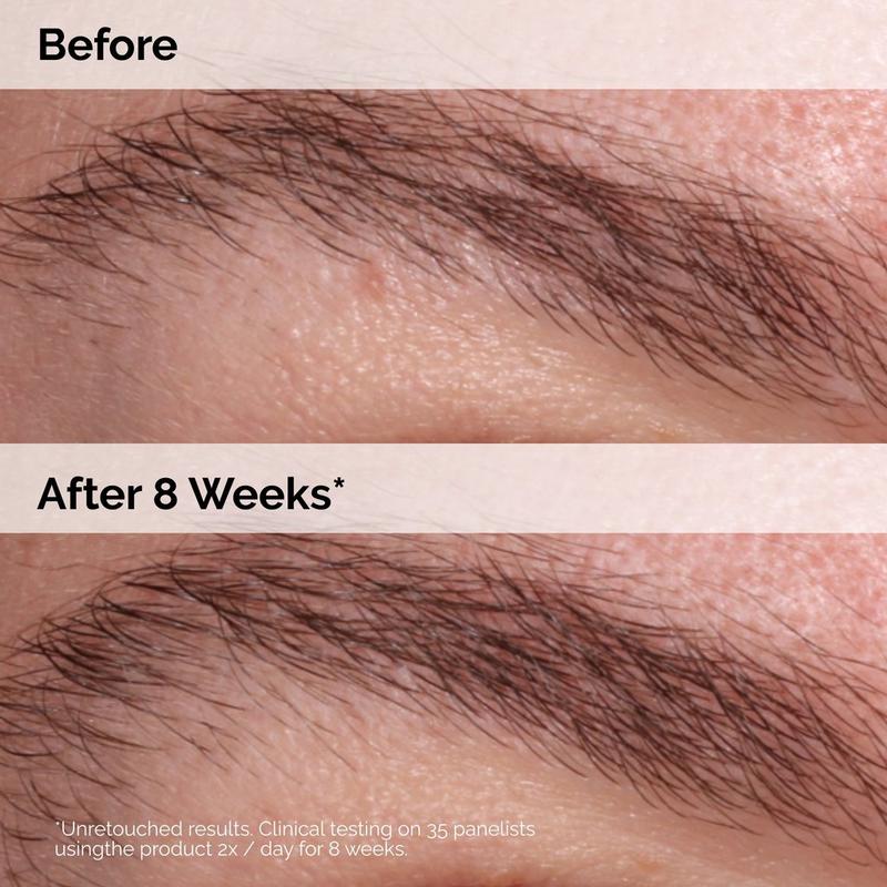The Ordinary Multi-Peptide Lash and Brow Serum for Thicker, Fuller Looking Lashes & Brows #4