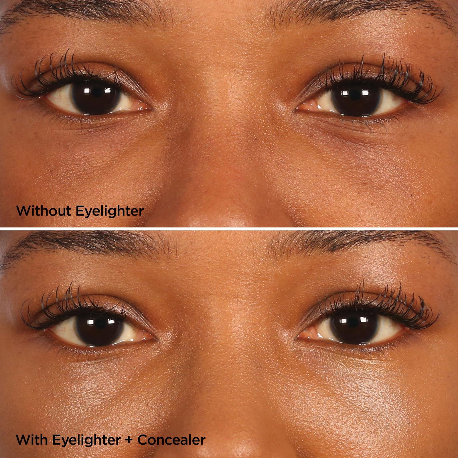 The Eyelighter Concentrate Serum & Depuffing Tool