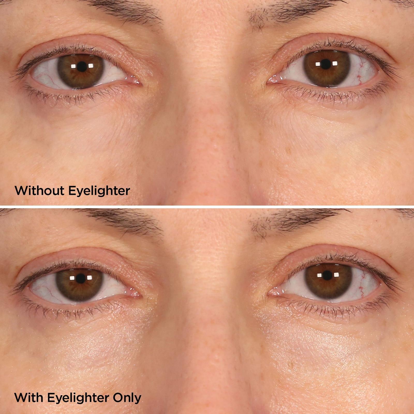 The Eyelighter Concentrate Serum & Depuffing Tool