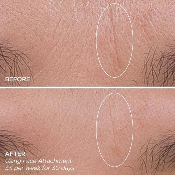 BeautyBio Get That Glow GloPRO Facial Microneedling Discovery Set #7