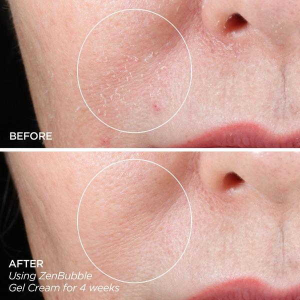 BeautyBio Get That Glow GloPRO Facial Microneedling Discovery Set #8