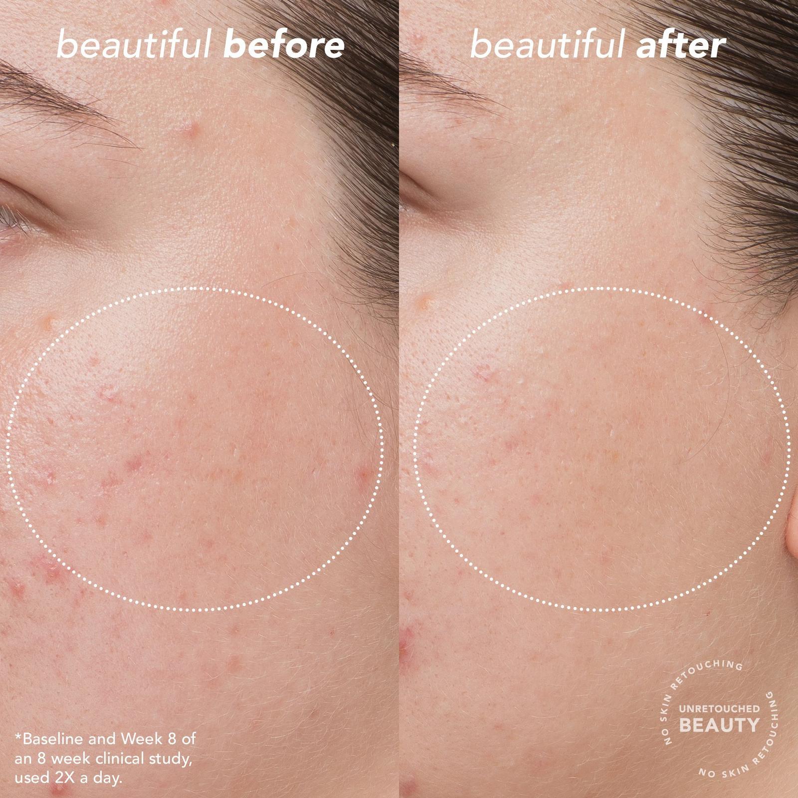 Bright Start Vitamin C Antioxidant Brightening Moisturizer