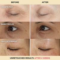 IT Cosmetics Confidence in an Eye Cream Anti-Aging Peptide Eye Cream #3