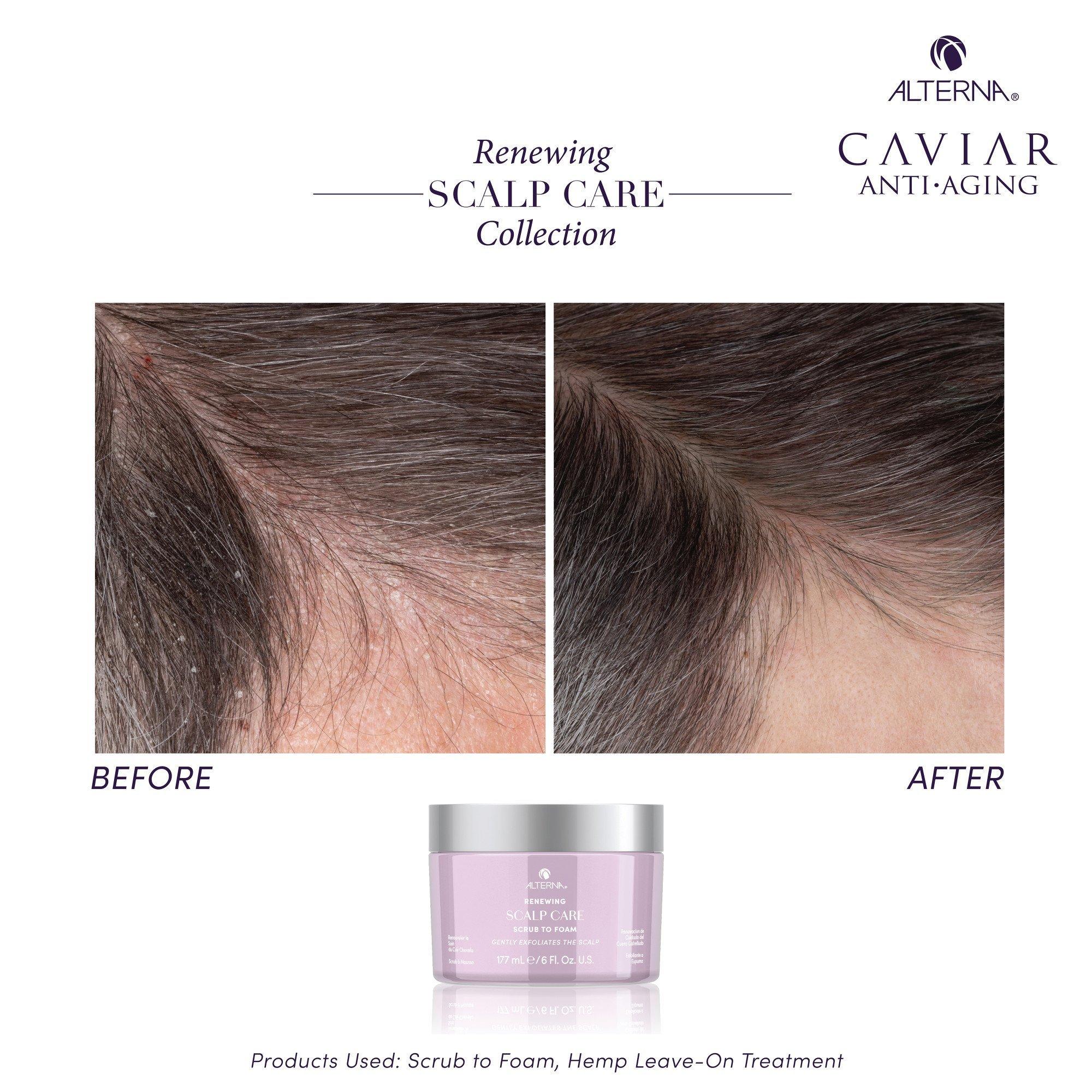 Пенящийся скраб для кожи головы Alterna Renewing Scalp Care — фото 5