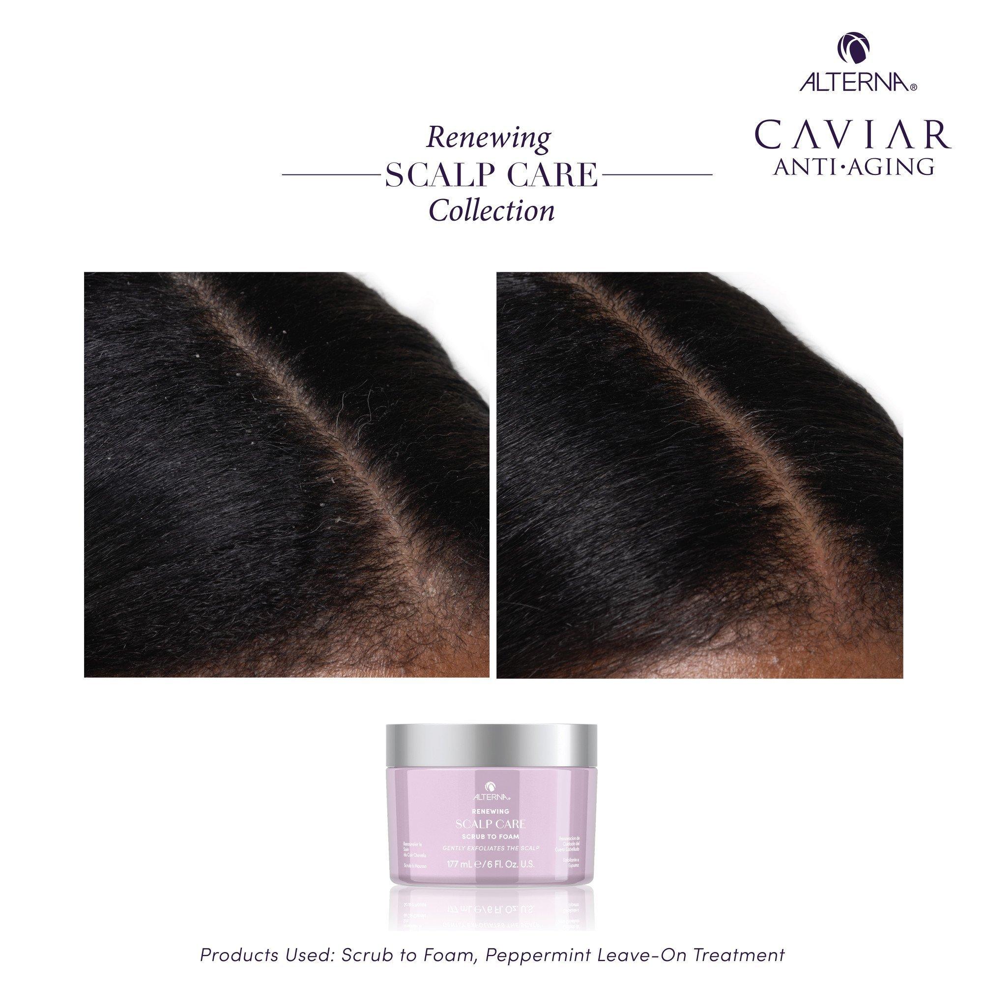 Пенящийся скраб для кожи головы Alterna Renewing Scalp Care — фото 6