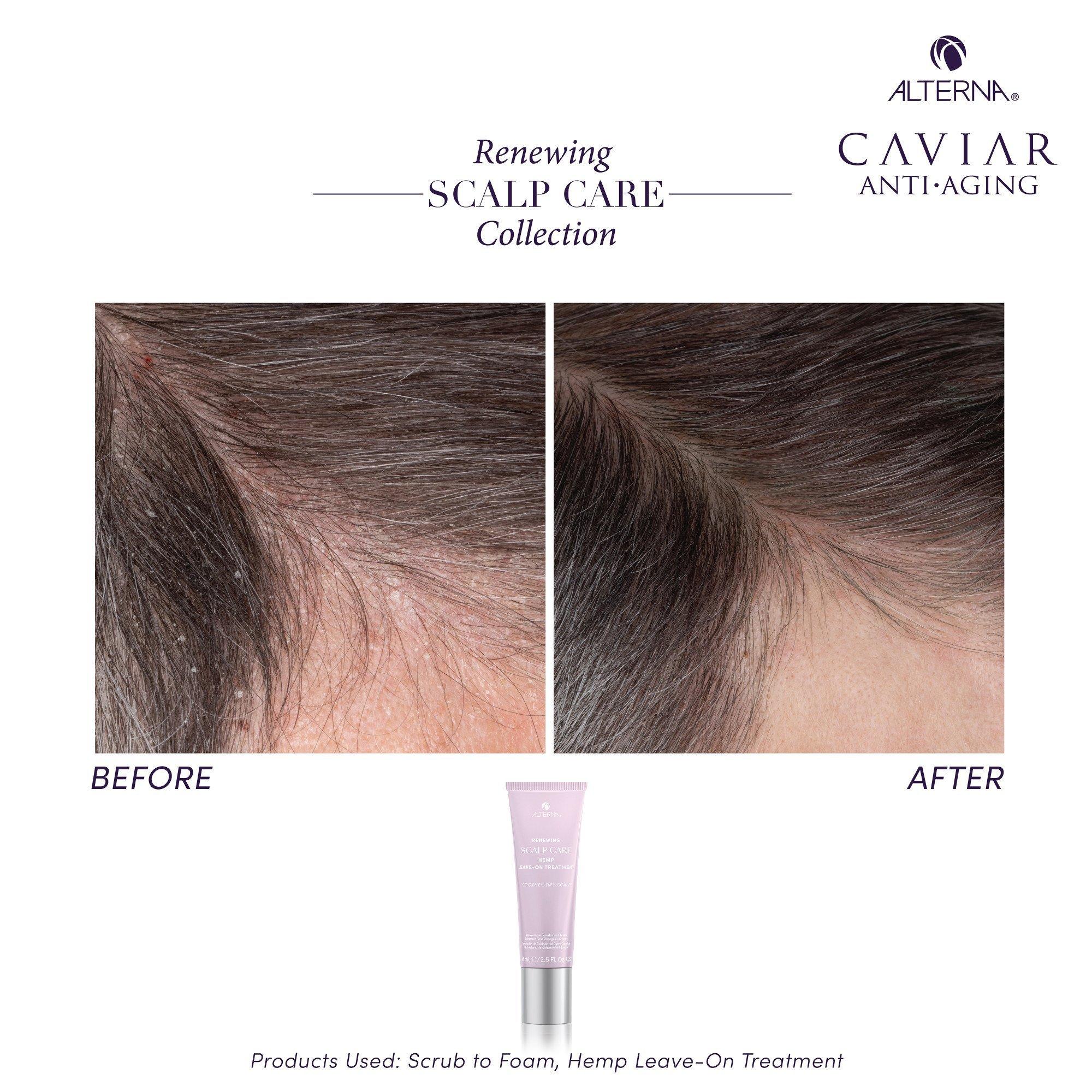 Несмываемое средство для кожи головы с коноплёй Alterna Scalp Care — фото 5
