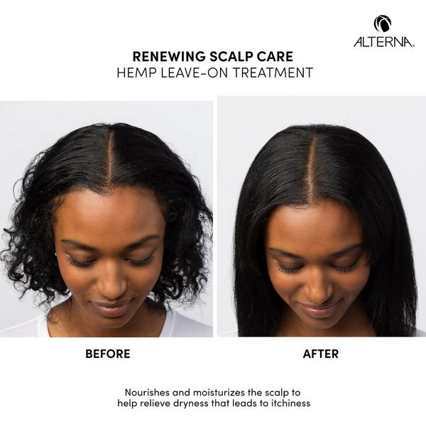 Alterna Scalp Care Hemp Leave-On Treatment #5