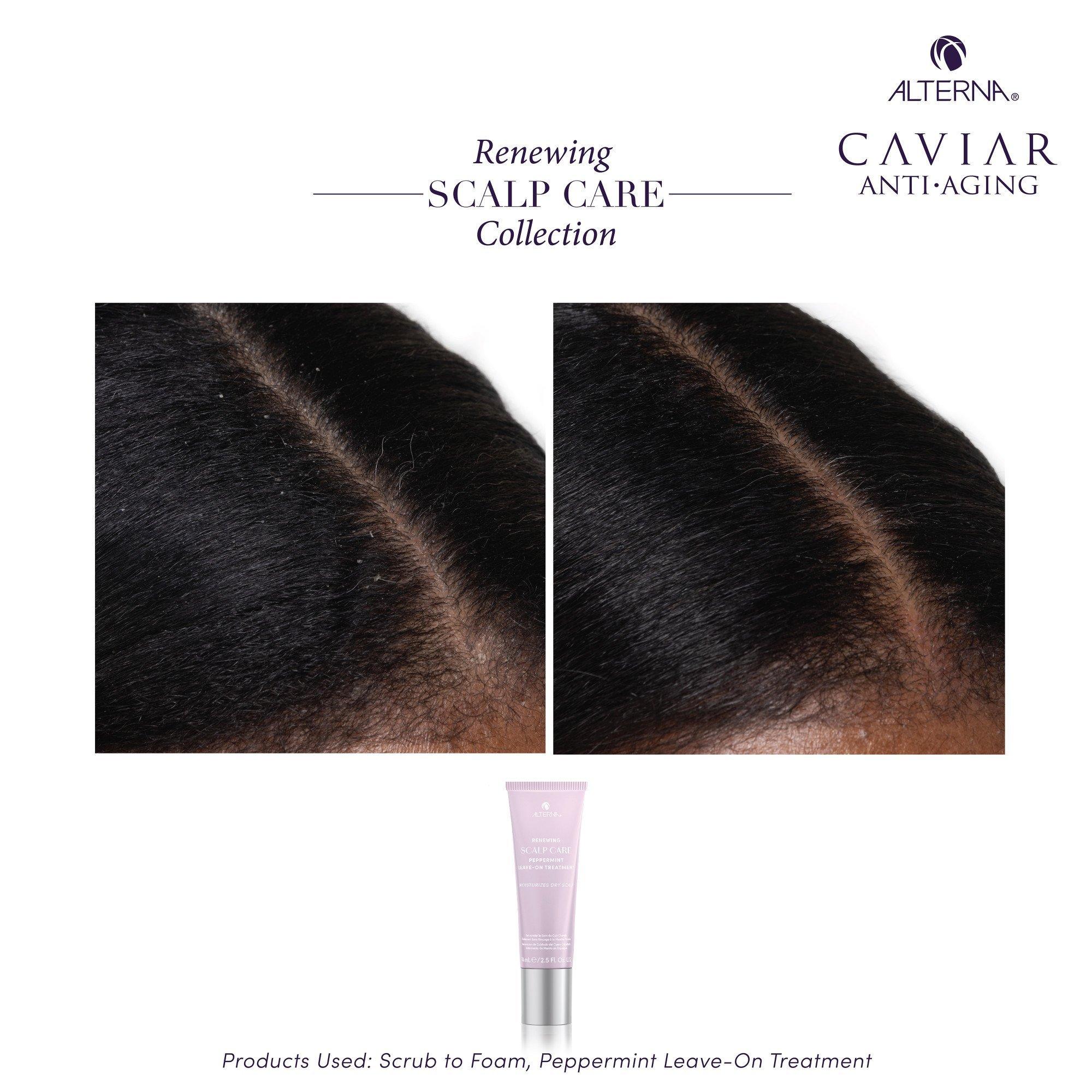 Несмываемое средство для кожи головы с мятой Alterna Scalp Care — фото 6
