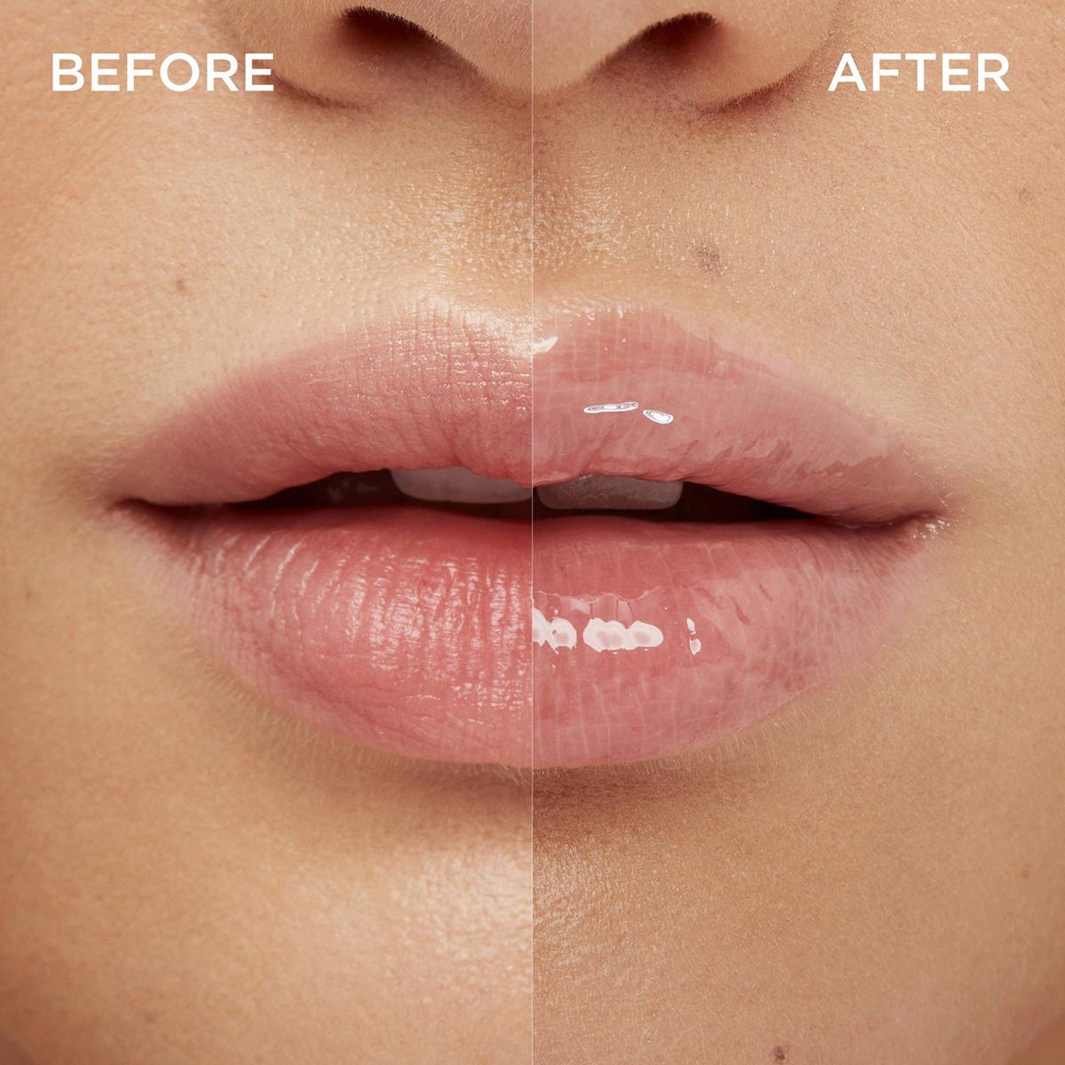 Lip Volume