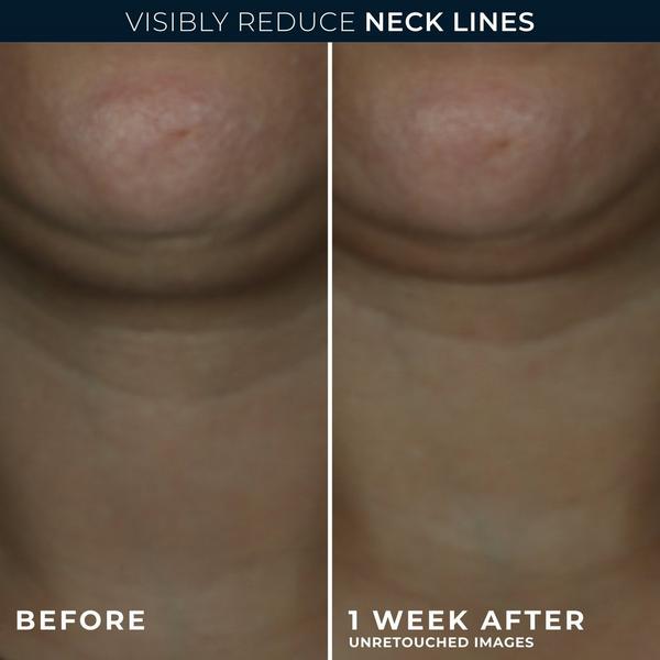 RoC Derm Correxion Contour Cream for Face and Neck #4