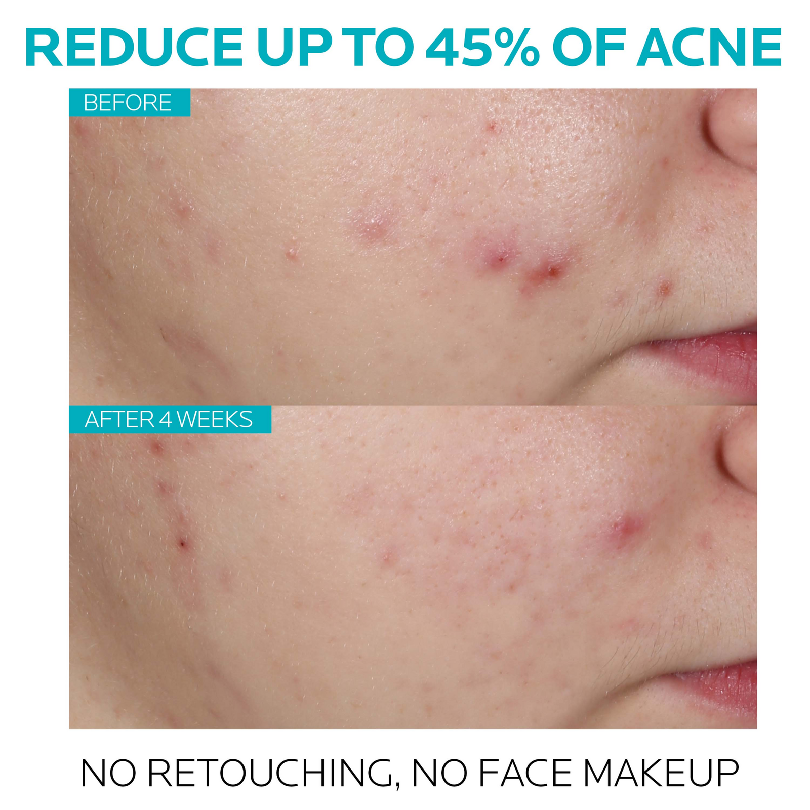 Effaclar Face Serum with Salicylic Acid