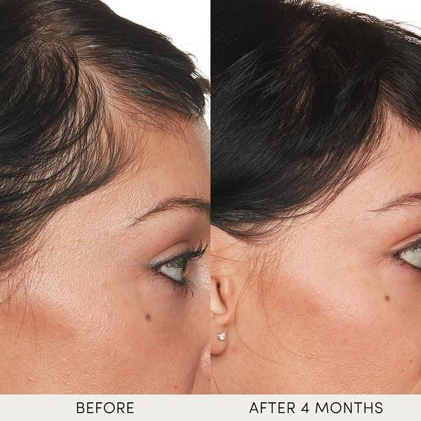 OUAI Hydrating Scalp Serum #4
