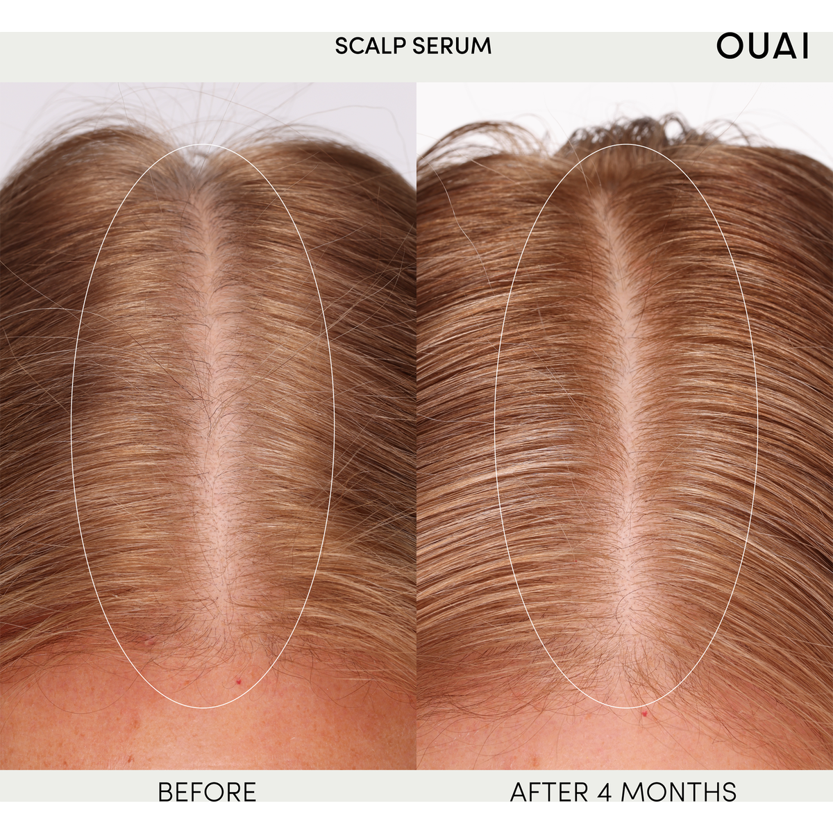 Ouai scalp deals serum