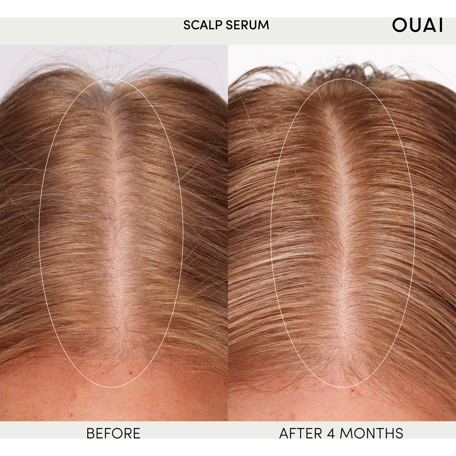 Scalp Serum