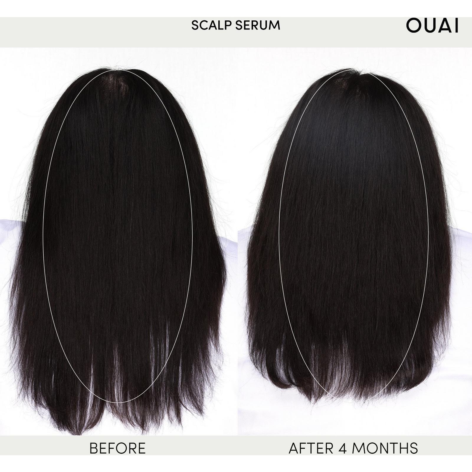Scalp Serum