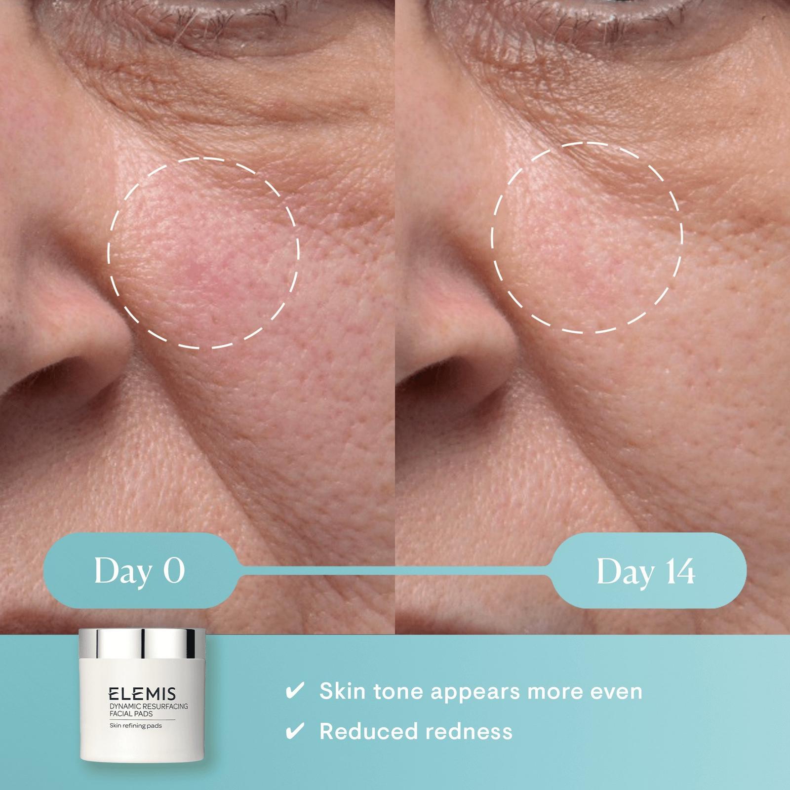 Dynamic Resurfacing Facial Pads