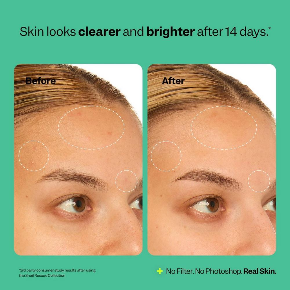 Snail Rescue Intensive Serum