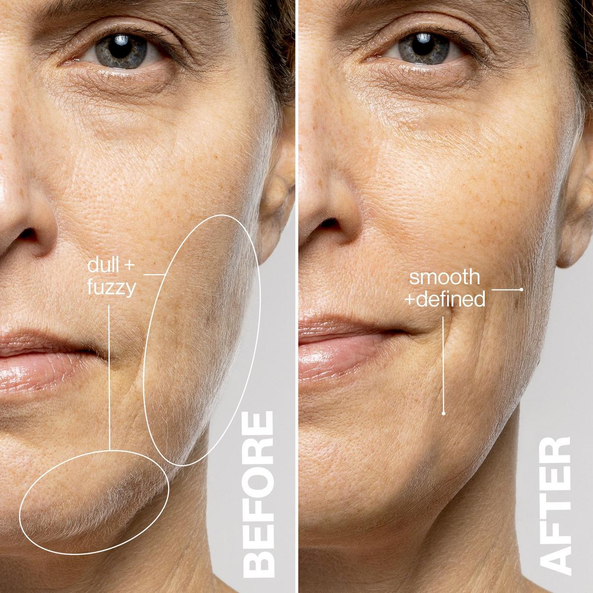 LUXE+ Advanced Sonic Dermaplaning + Peach Fuzz Removal