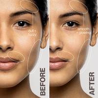 DERMAFLASH LUXE+ Advanced Sonic Dermaplaning + Peach Fuzz Removal #6