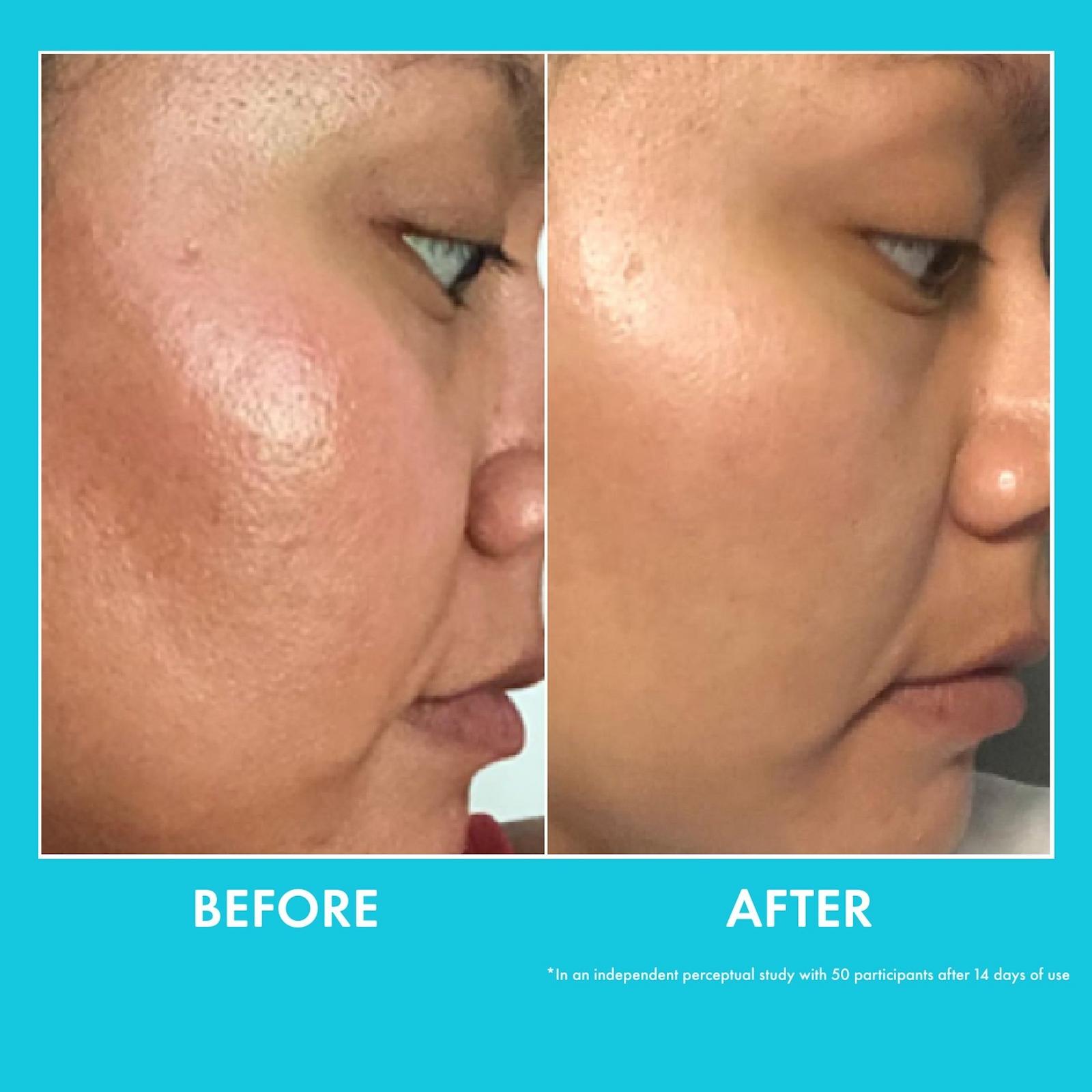 Moisture Whipped Ceramide Cream