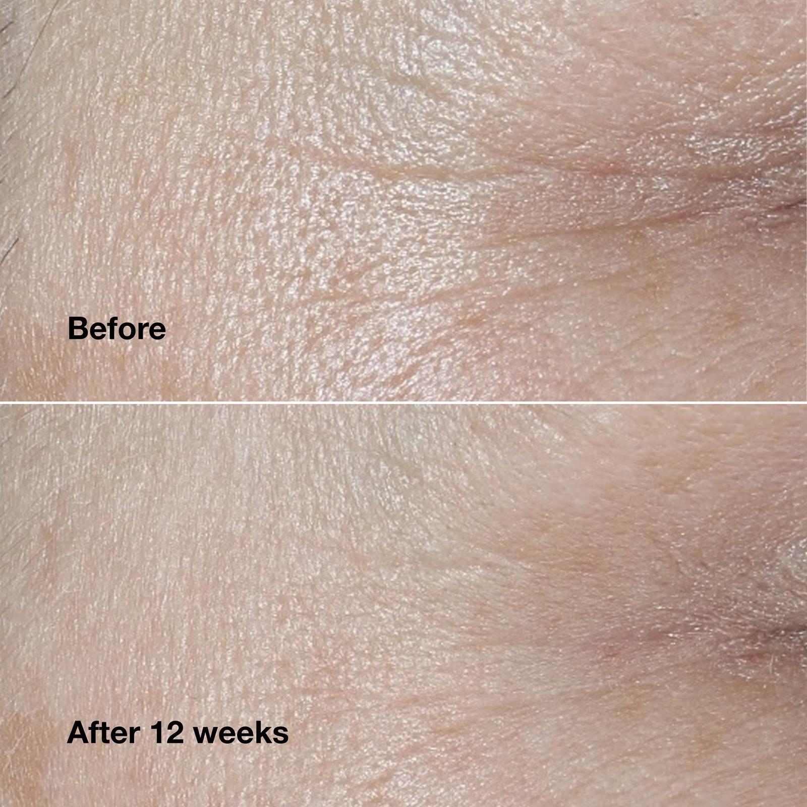 Clinique Smart Clinical Repair Wrinkle Correcting Face Cream