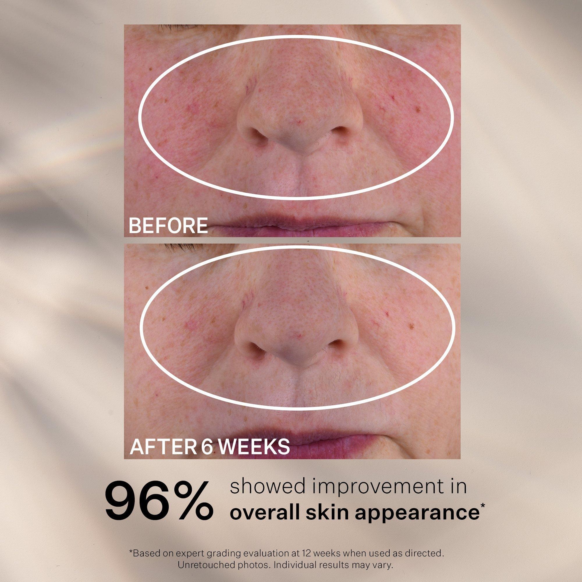 Ночная корректирующая сыворотка StriVectin Advanced Retinol Multi-Correct — фото 7