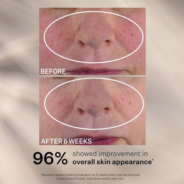 StriVectin Advanced Retinol Nightly Multi-Correct Serum #7