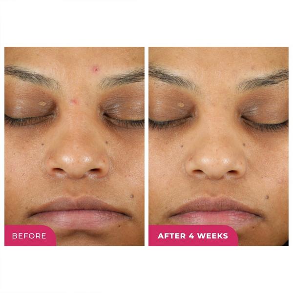 BeautyStat Cosmetics Triple Action One-Step Daily Exfoliating Peel Pad #4