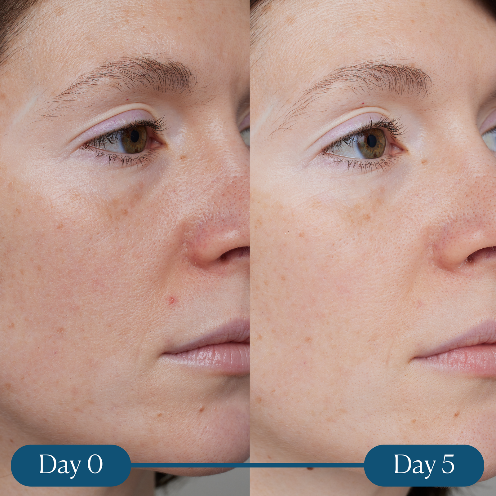 Dynamic Resurfacing Super-C Serum