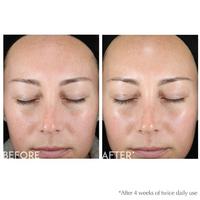 Exuviance Gentle Daily Exfoliating Face Pads #5