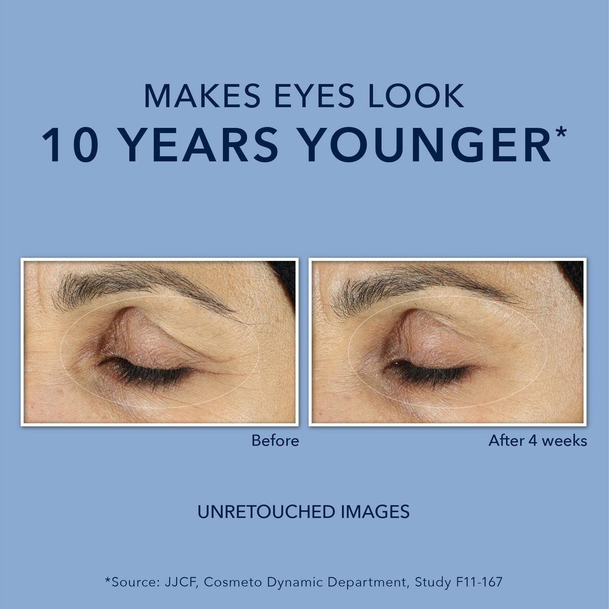 Retinol Line Smoothing Anti Wrinkle for Dark Circles Eye Cream