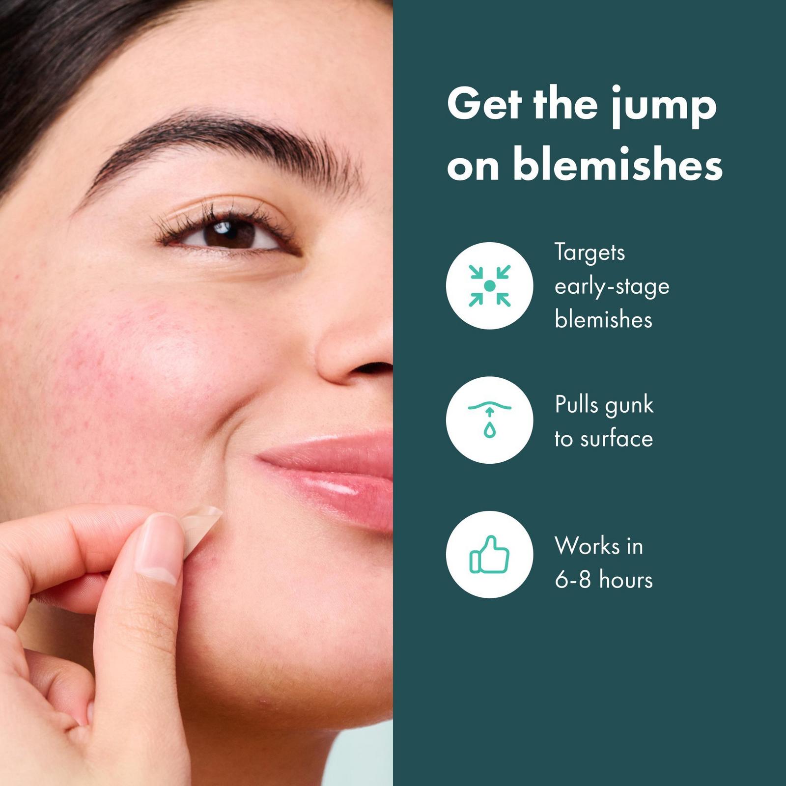 Mighty Patch Micropoint for Blemishes Patches