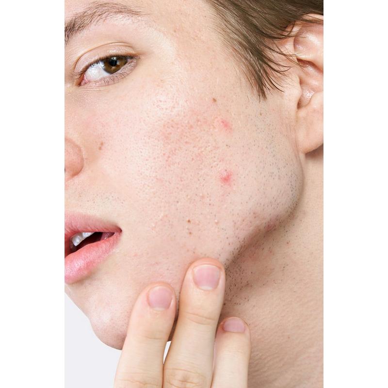 Hero Cosmetics Mighty Patch Micropoint for Blemishes Patches #8